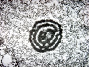 M,61y. | activated nucleolus - salivary gland M,61y. | activated nucleolus - salivary gland